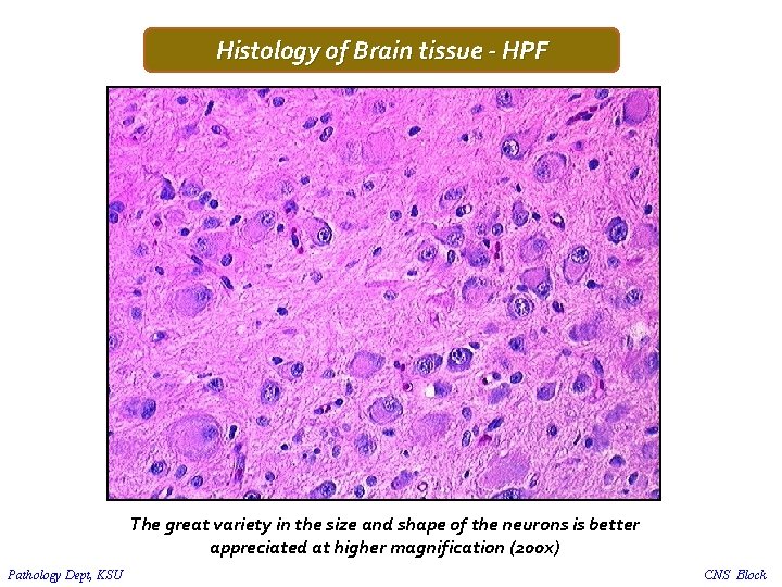 Histology of Brain tissue - HPF The great variety in the size and shape