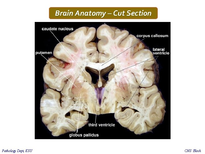 Brain Anatomy – Cut Section Pathology Dept, KSU CNS Block 