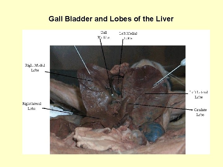  Gall Bladder and Lobes of the Liver 