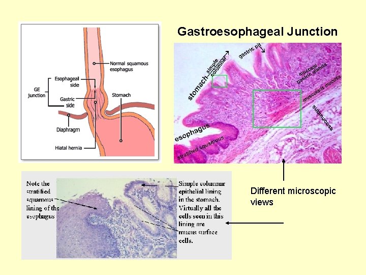 Gastroesophageal Junction Different microscopic views 