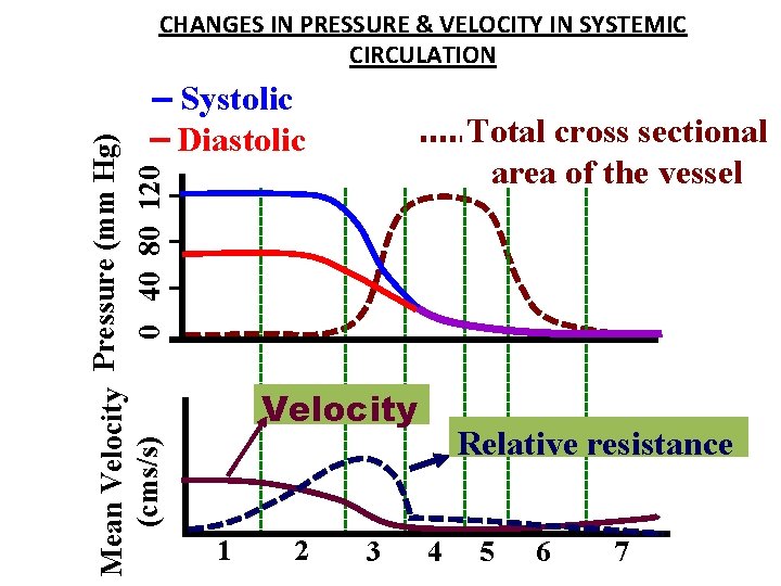Mean Velocity Pressure (mm Hg) (cms/s) 0 40 80 120 CHANGES IN PRESSURE & Mean Velocity Pressure (mm Hg) (cms/s) 0 40 80 120 CHANGES IN PRESSURE &