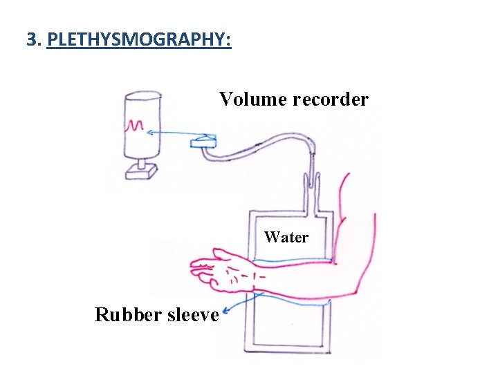 3. PLETHYSMOGRAPHY: Volume recorder Water Rubber sleeve 3. PLETHYSMOGRAPHY: Volume recorder Water Rubber sleeve