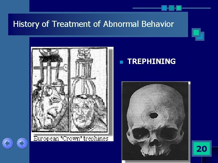 History of Treatment of Abnormal Behavior n TREPHINING 20 