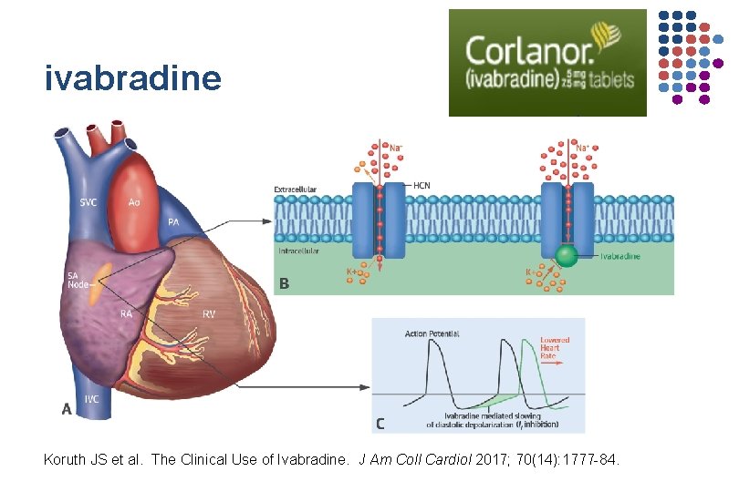 ivabradine Koruth JS et al. The Clinical Use of Ivabradine. J Am Coll Cardiol