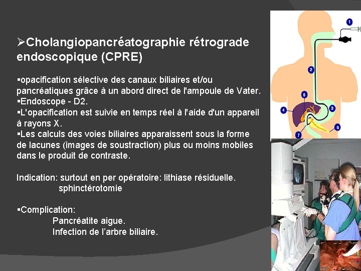 ØCholangiopancréatographie rétrograde endoscopique (CPRE) §opacification sélective des canaux biliaires et/ou pancréatiques grâce à un