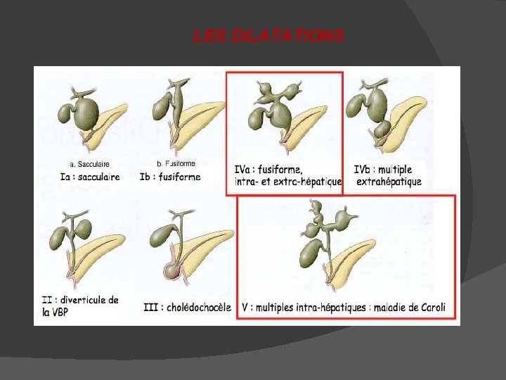 LES DILATATIONS 