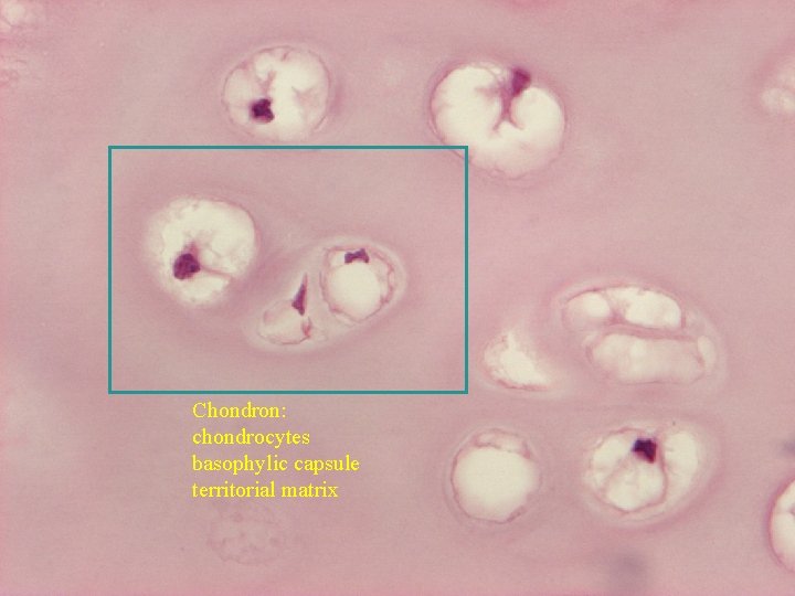 Chondron: chondrocytes basophylic capsule territorial matrix 
