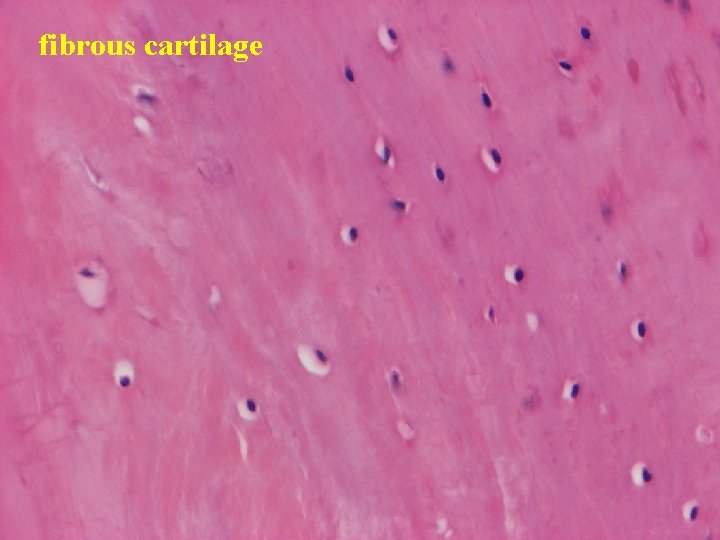 fibrous cartilage 