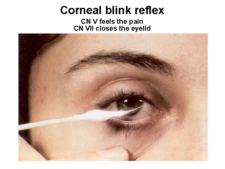 Corneal blink reflex CN V feels the pain CN VII closes the eyelid 156