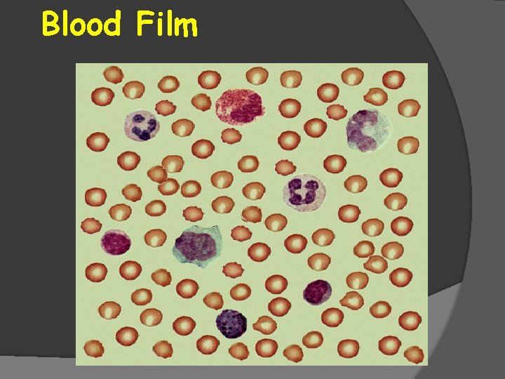 Blood Film 