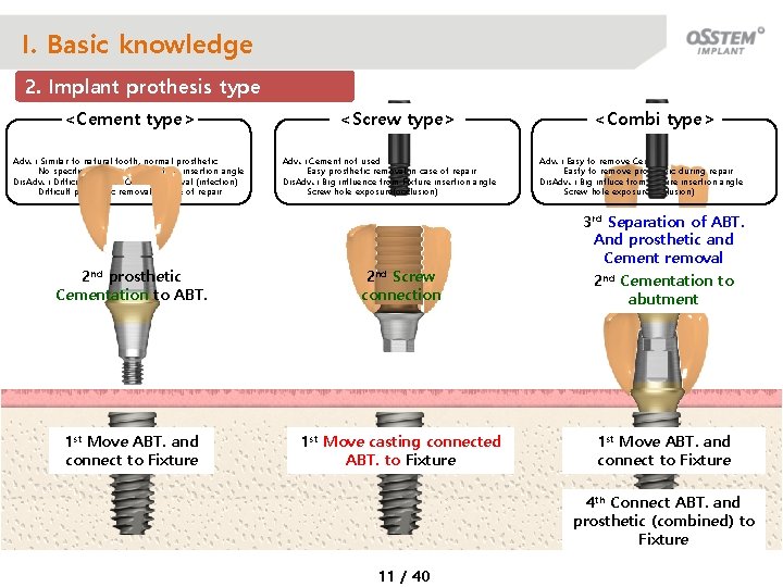 I. Basic knowledge 2. Implant prothesis type <Cement type> Adv. : Similar to natural
