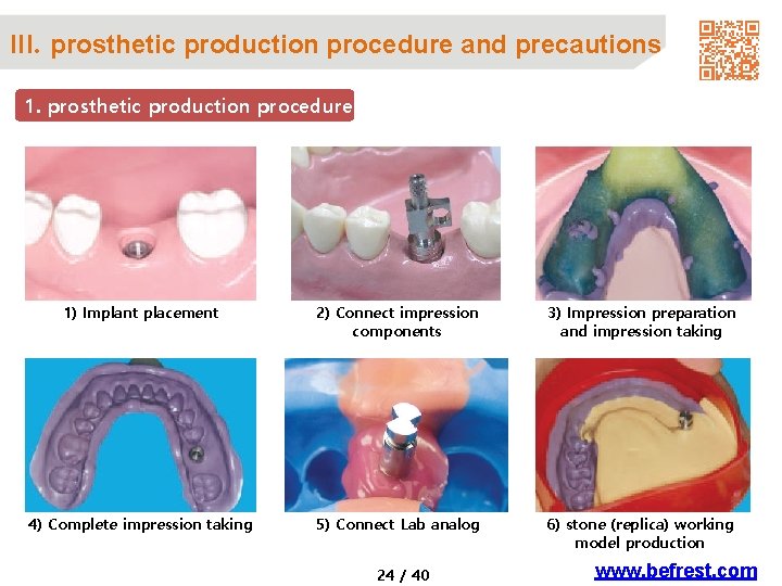 III. prosthetic production procedure and precautions 1. prosthetic production procedure 1) Implant placement 2)