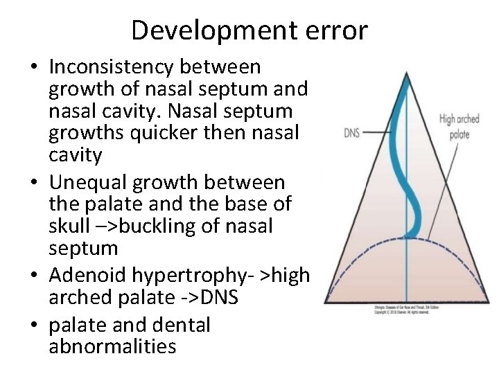 Development error • Inconsistency between growth of nasal septum and nasal cavity. Nasal septum