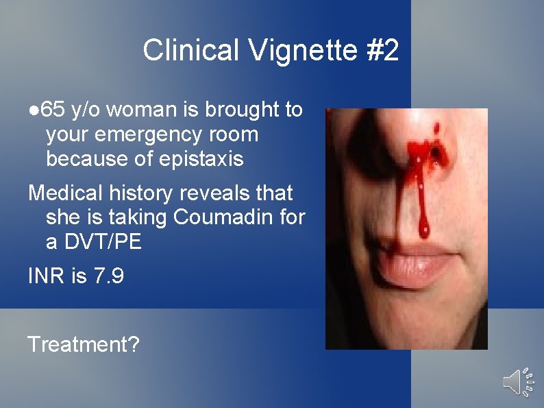 Clinical Vignette #2 ● 65 y/o woman is brought to your emergency room because