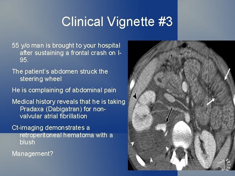Clinical Vignette #3 55 y/o man is brought to your hospital after sustaining a
