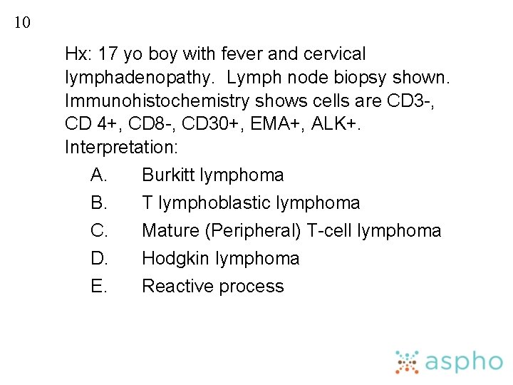 10 Hx: 17 yo boy with fever and cervical lymphadenopathy. Lymph node biopsy shown.