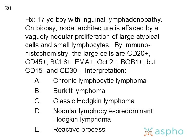 20 Hx: 17 yo boy with inguinal lymphadenopathy. On biopsy, nodal architecture is effaced