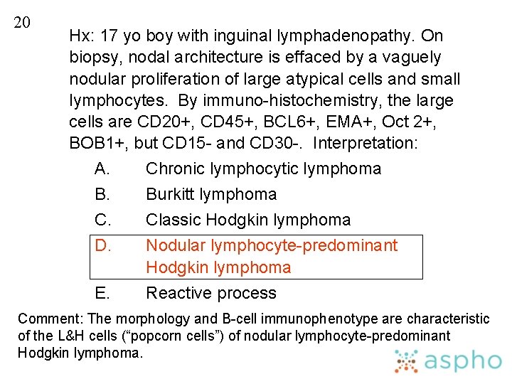 20 Hx: 17 yo boy with inguinal lymphadenopathy. On biopsy, nodal architecture is effaced