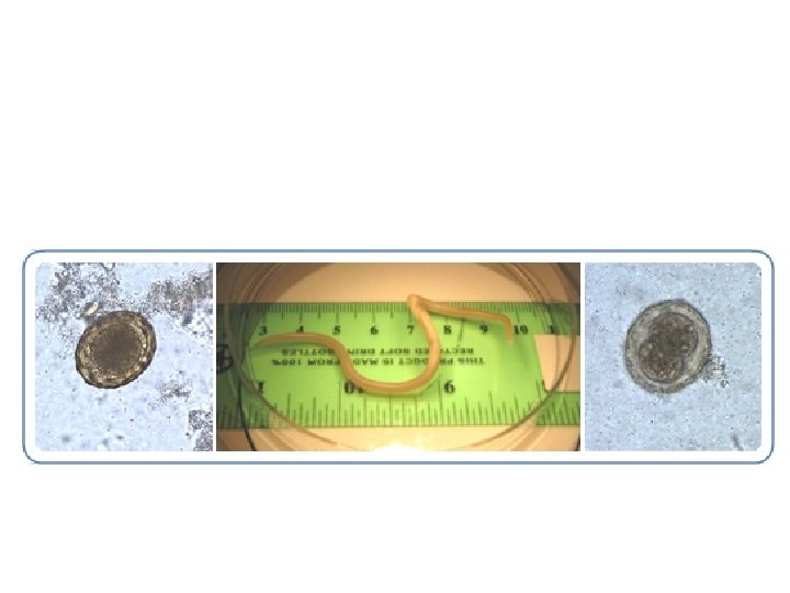 2. Ascaris lumbricoides = the common roundworm 2. Ascaris lumbricoides = the common roundworm