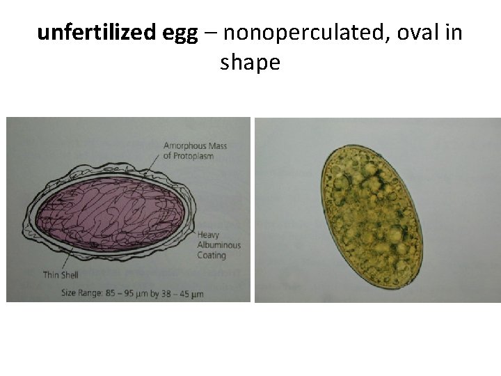 unfertilized egg – nonoperculated, oval in shape unfertilized egg – nonoperculated, oval in shape