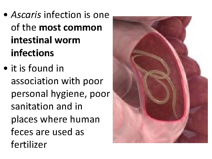• Ascaris infection is one of the most common intestinal worm infections • • Ascaris infection is one of the most common intestinal worm infections •