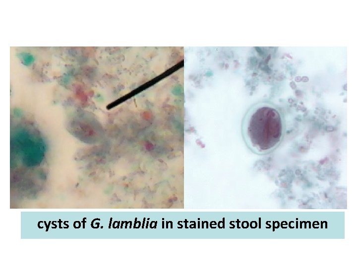 cysts of G. lamblia in stained stool specimen cysts of G. lamblia in stained stool specimen