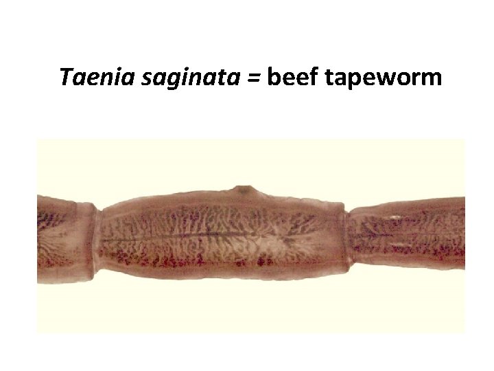 Taenia saginata = beef tapeworm Taenia saginata = beef tapeworm