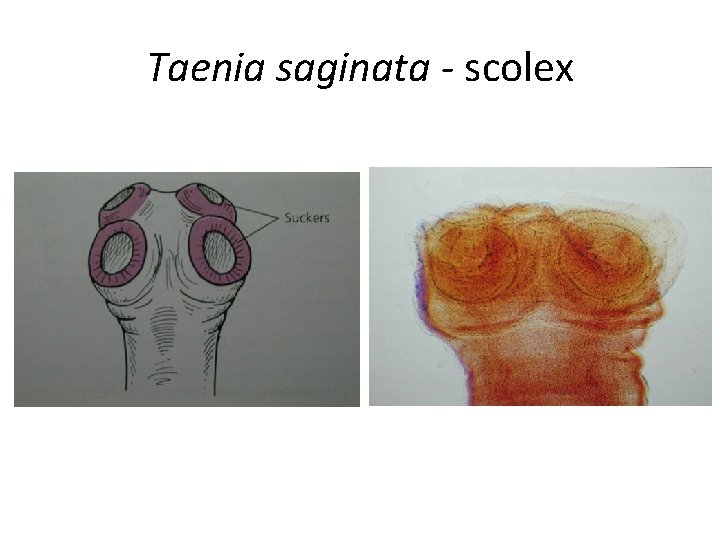 Taenia saginata - scolex Taenia saginata - scolex