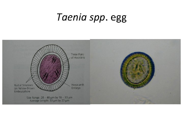 Taenia spp. egg Taenia spp. egg