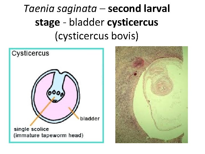 Taenia saginata – second larval stage - bladder cysticercus (cysticercus bovis) Taenia saginata – second larval stage - bladder cysticercus (cysticercus bovis)