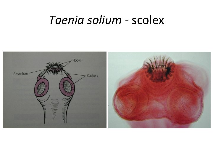 Taenia solium - scolex Taenia solium - scolex