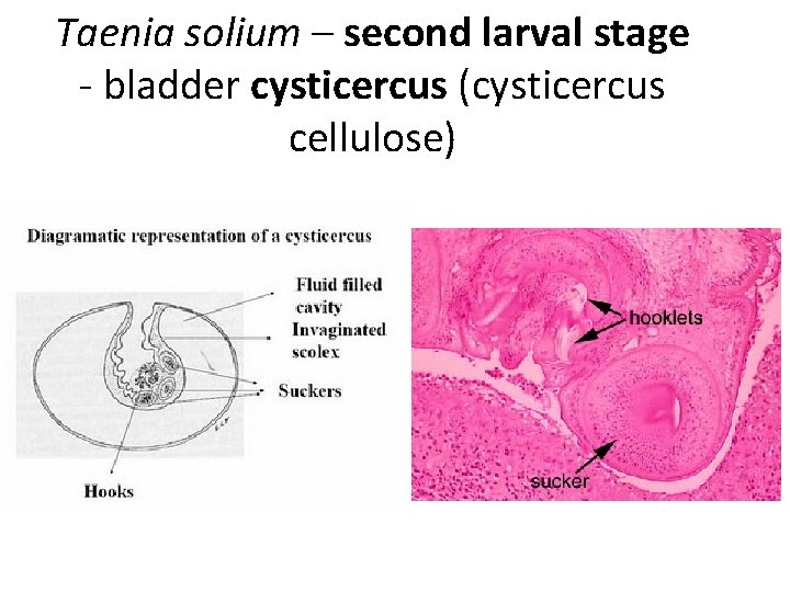 Taenia solium – second larval stage - bladder cysticercus (cysticercus cellulose) Taenia solium – second larval stage - bladder cysticercus (cysticercus cellulose)