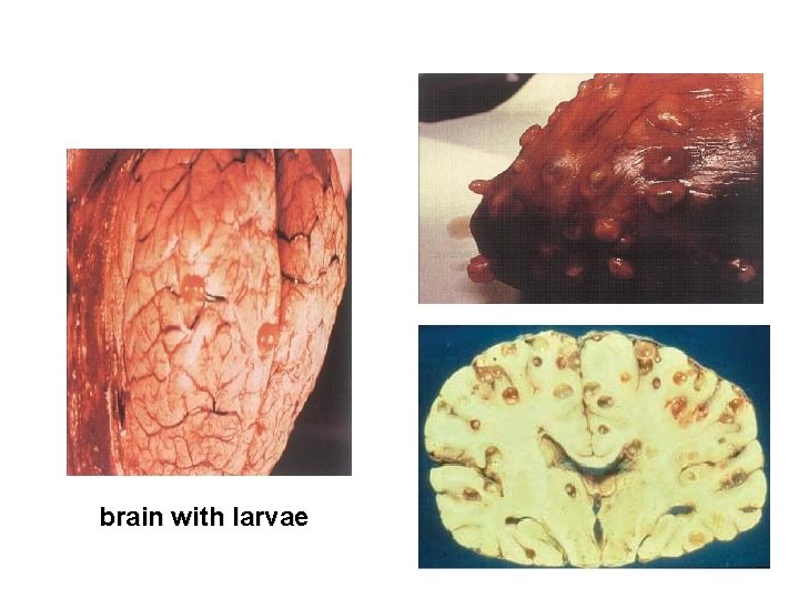brain with larvae brain with larvae