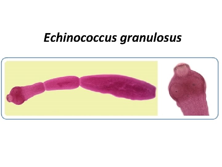 Echinococcus granulosus Echinococcus granulosus