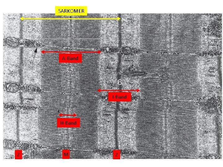 SARKOMER A-Band I-Band H-Band Z M Z 