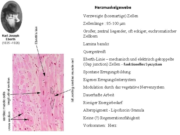 Herzmuskelgewebe Verzweigte (hosenartige) Zellenlänge : 85 -100 μm Karl Joseph Eberth (1835 – 1926)