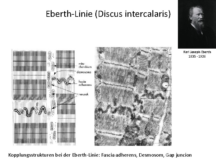 Eberth-Linie (Discus intercalaris) Karl Joseph Eberth 1835 - 1926 Kopplungsstrukturen bei der Eberth-Linie: Fascia