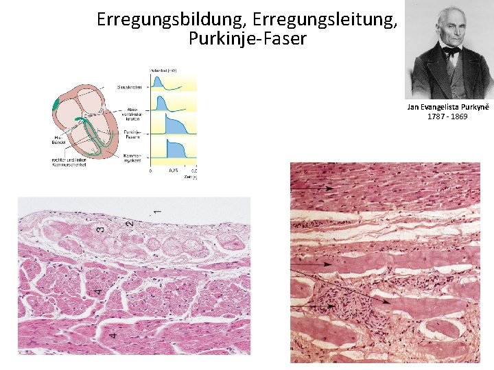 Erregungsbildung, Erregungsleitung, Purkinje-Faser Jan Evangelista Purkyně 1787 - 1869 