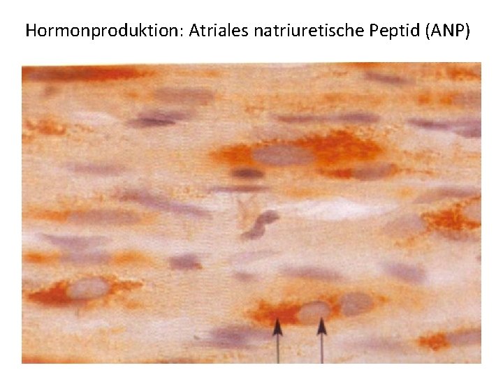 Hormonproduktion: Atriales natriuretische Peptid (ANP) 