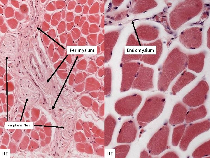 Perimysium Endomysium Peripherer Nerv HE HE 