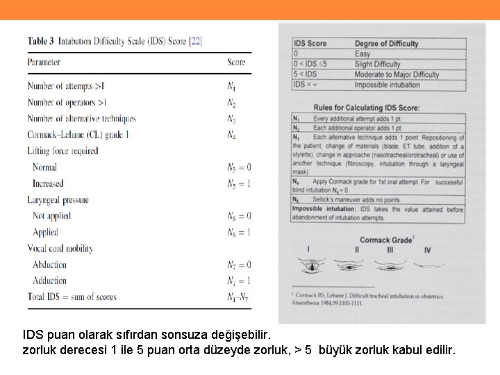 IDS puan olarak sıfırdan sonsuza değişebilir. zorluk derecesi 1 ile 5 puan orta düzeyde