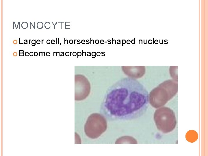 MONOCYTE Larger cell, horseshoe-shaped nucleus Become macrophages 