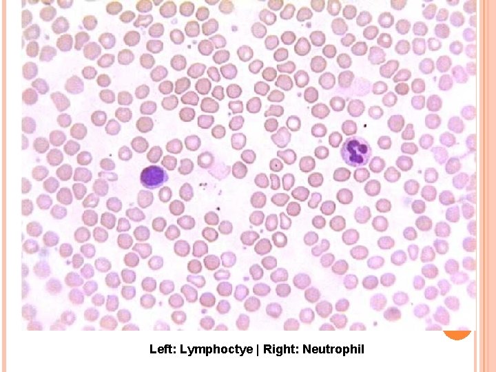 Left: Lymphoctye | Right: Neutrophil 