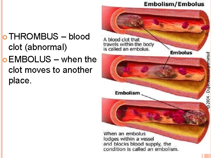  THROMBUS – blood clot (abnormal) EMBOLUS – when the clot moves to another