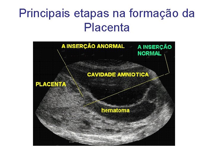 Principais etapas na formação da Placenta 