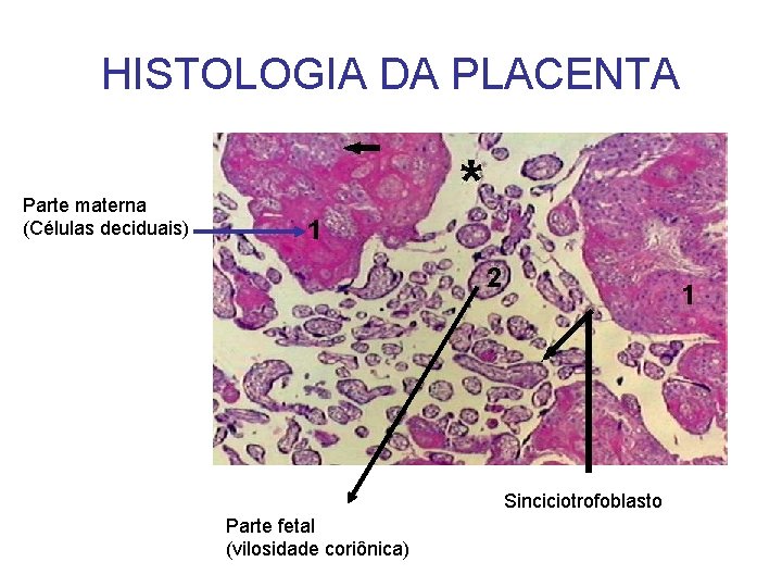 HISTOLOGIA DA PLACENTA Parte materna (Células deciduais) Sinciciotrofoblasto Parte fetal (vilosidade coriônica) 