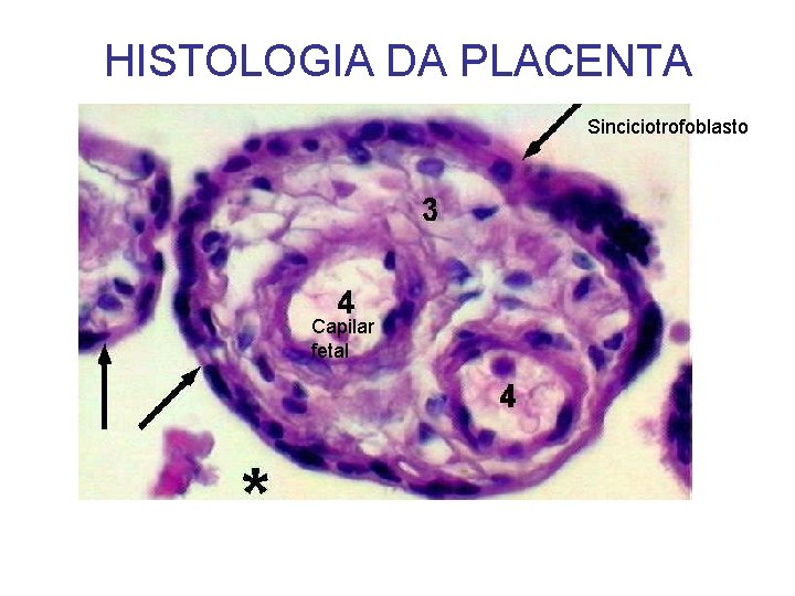 HISTOLOGIA DA PLACENTA Sinciciotrofoblasto Capilar fetal 