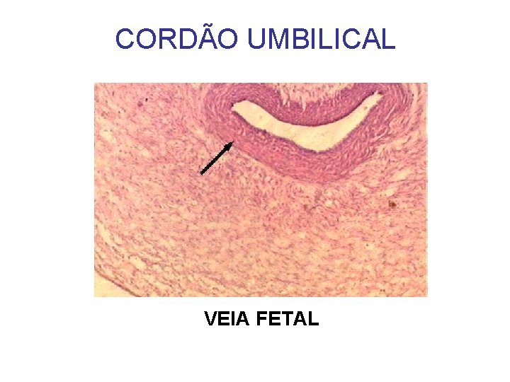 CORDÃO UMBILICAL VEIA FETAL 