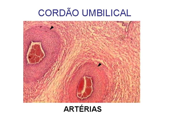 CORDÃO UMBILICAL ARTÉRIAS 