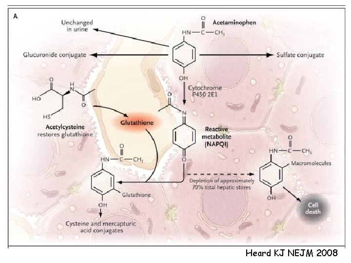 Heard KJ NEJM 2008 